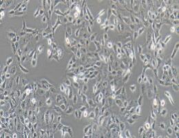 人前列腺癌细胞；DU145