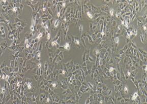 人纤维肉瘤细胞；HT-1080