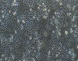 人结直肠腺癌细胞；HT-29