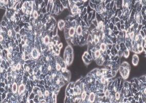 人绒毛膜癌细胞；JEG-3