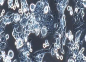 人脑胶质母细胞瘤细胞；LN-18