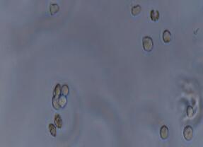 人急性淋巴母细胞性白血病细胞；MOLT-4