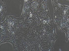 人肺腺癌细胞；NCI-H441