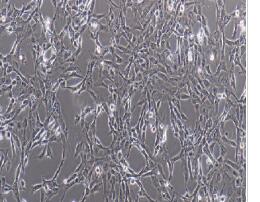人小肠上皮细胞；WPMY-1