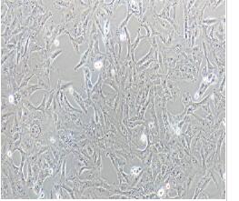 人脑胶质母细胞瘤细胞；T98G