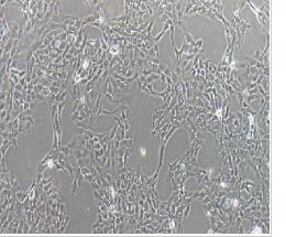 人卵巢腺癌细胞；SK-OV-3