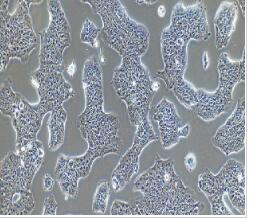 人膀胱移行细胞乳头瘤细胞；RT4