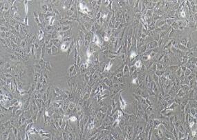 人胆管细胞型肝癌细胞；RBE