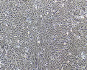小鼠肾小球系膜细胞；SV40 MES 13