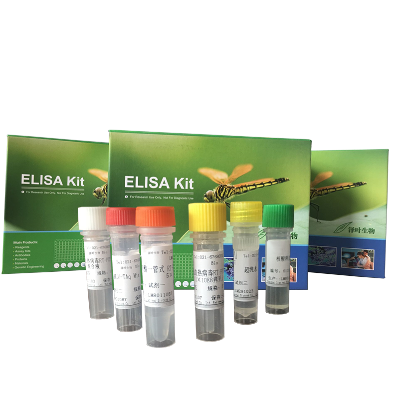 人免疫缺陷病毒1型M群G型荧光定量PCR试剂盒（探针法）