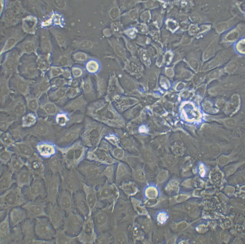 NCI-H508 Cell:人结肠直肠腺癌细胞系