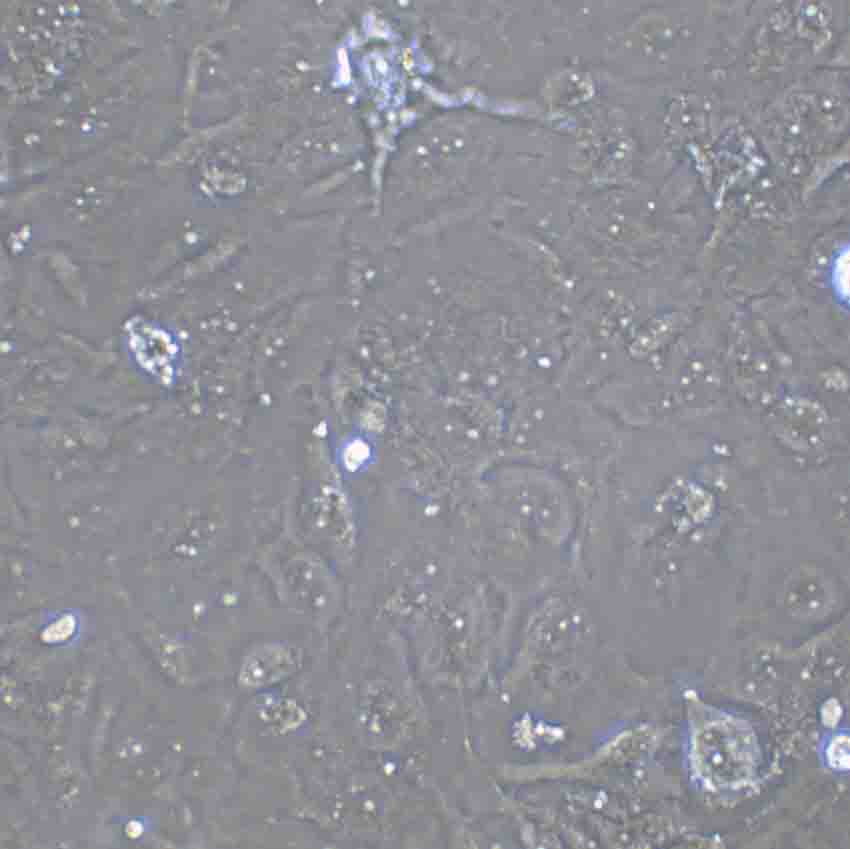 NCI-H446 Cell:人小细胞肺癌细胞系