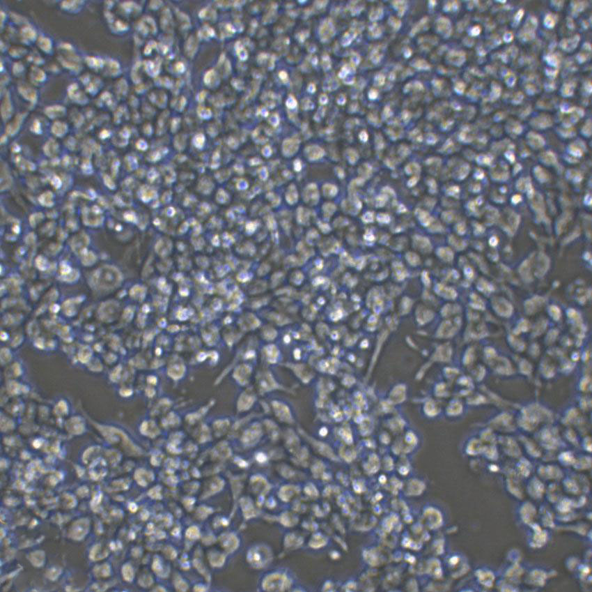 NCI-H226 Cell:人肺鳞癌细胞系