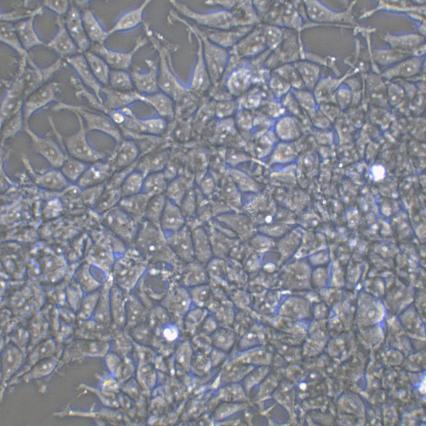 NCI-H1755 Cell:人肺癌细胞系