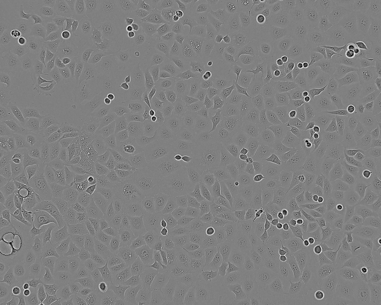 HCC827 Cell:人非小细胞肺癌细胞系