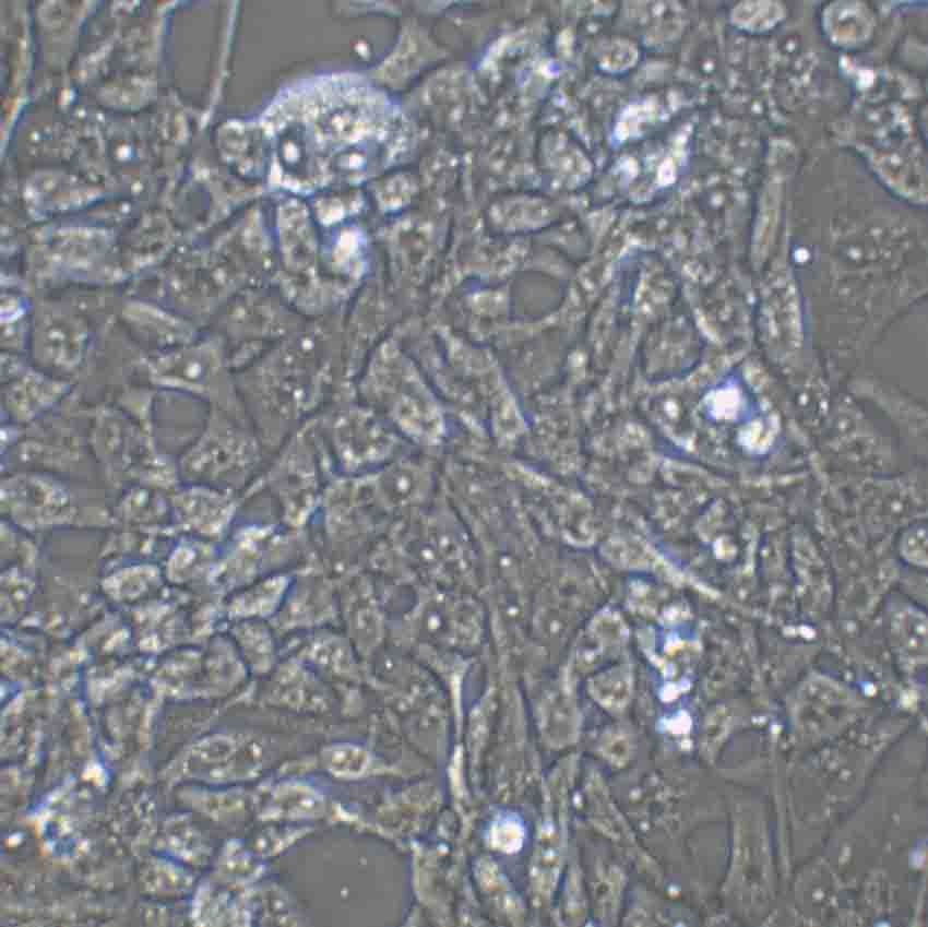 SNU-398 Cell:人肝癌细胞系