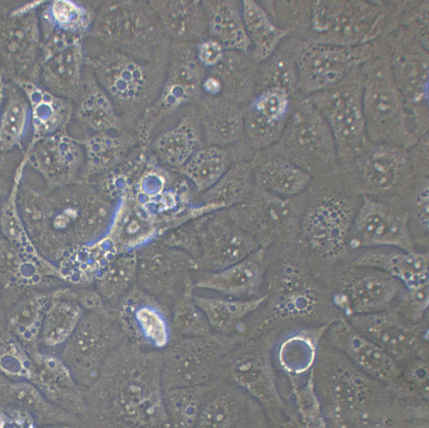 BEL-7404 Cell:人肝癌细胞系