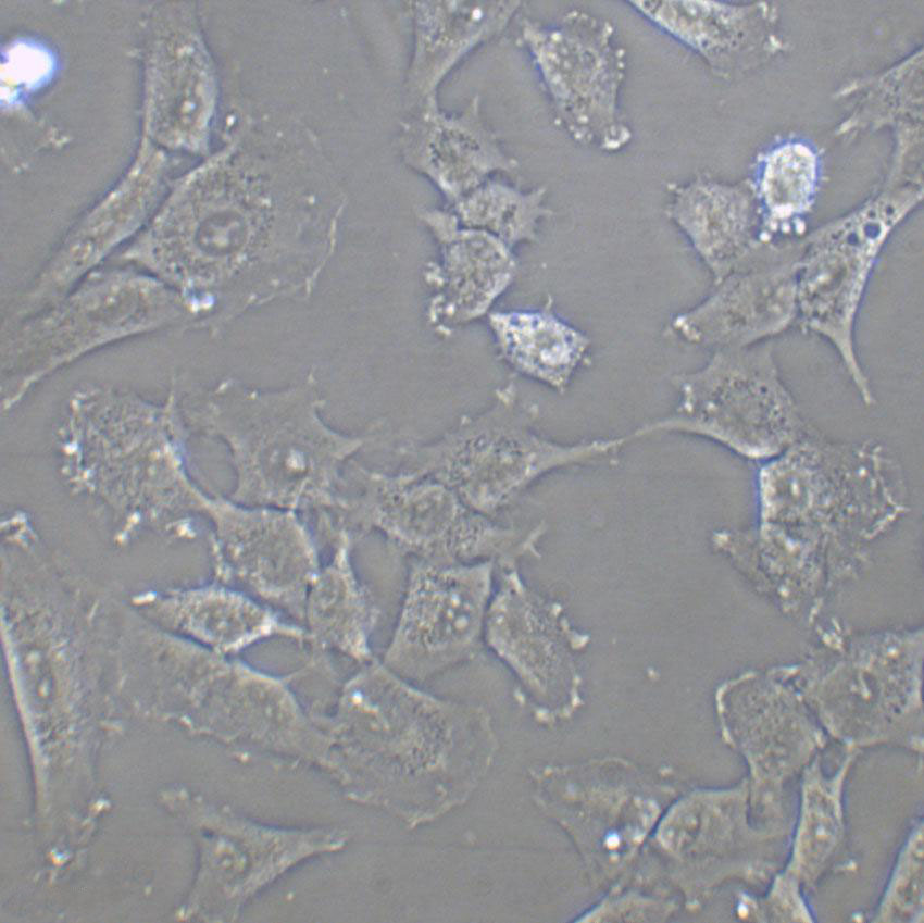 NCI-H1975 Cell:人肺腺癌细胞系