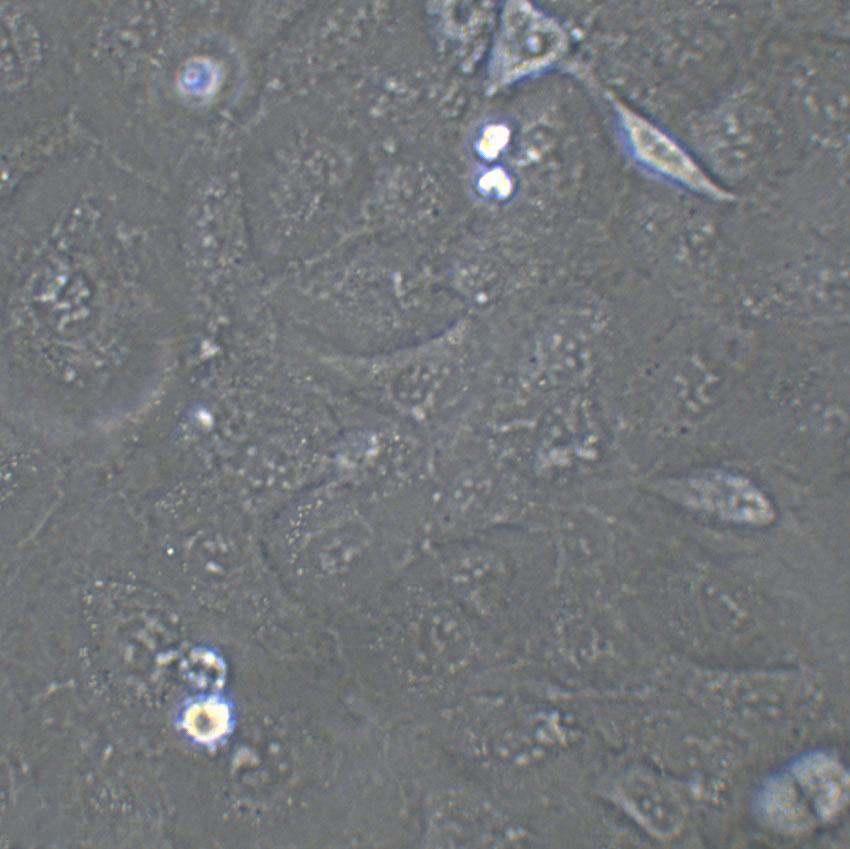 Calu-1 Cell:人肺腺癌细胞系
