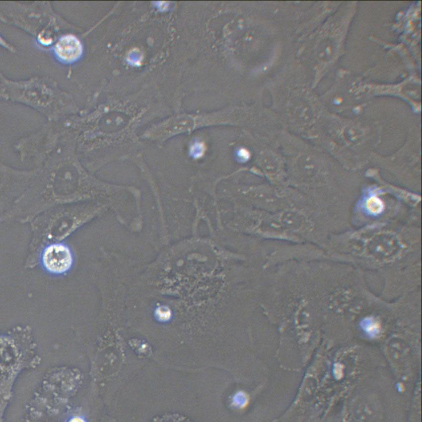 NB4 Cell:急性早幼粒细胞系