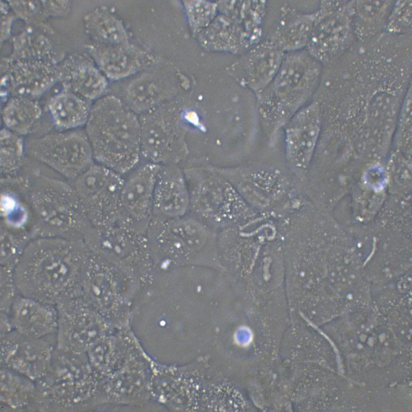 HEp-2 Cell:人喉表皮样癌细胞系