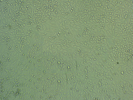 T24 Cell:人膀胱移行细胞癌细胞系