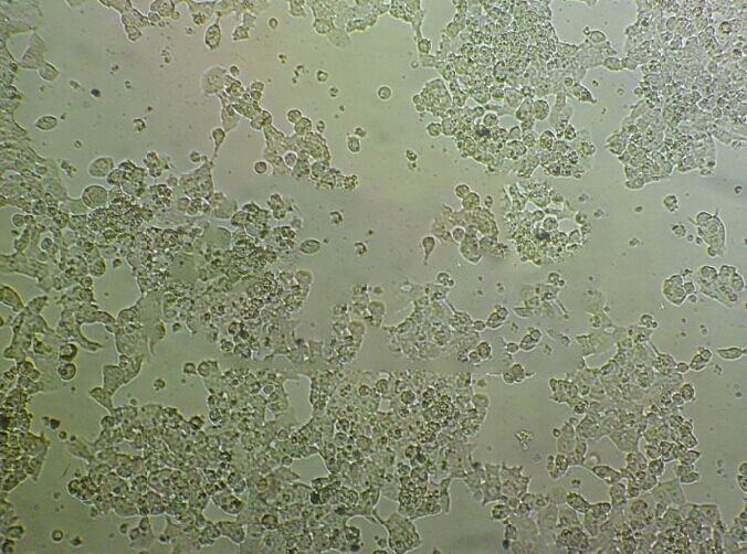 MDA-MB-468 Cell:人乳腺癌细胞系