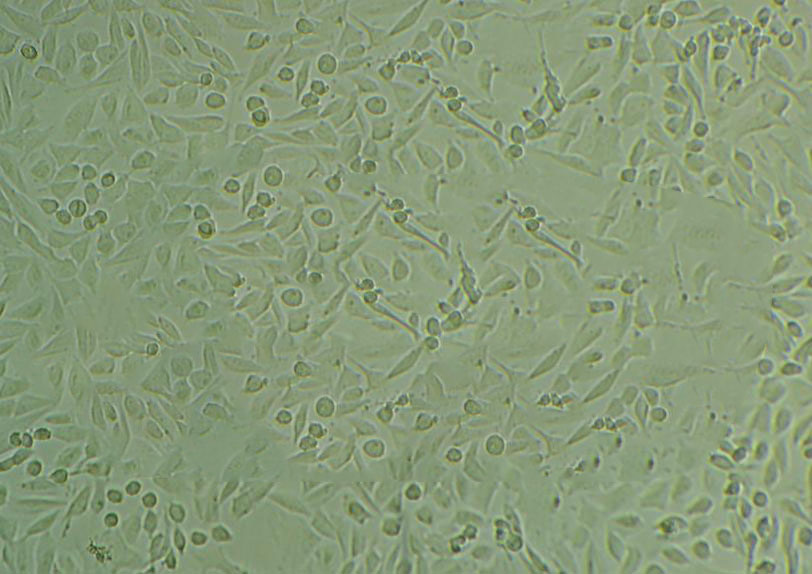 SCC-9 Cell:人类鳞状上皮舌癌细胞系