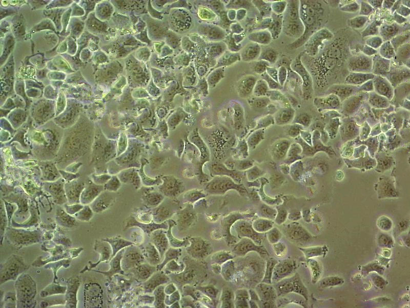 KP-N-NS Cell:人肾上腺神经母细胞瘤细胞系