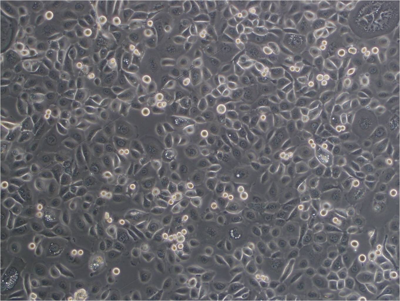 F56 [Human neoplasm] Cell:人腺癌细胞系