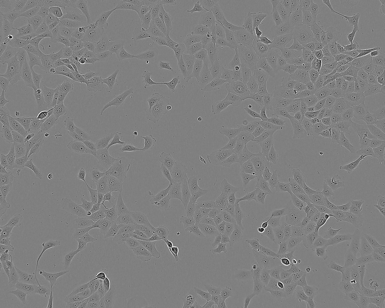 HeLa Cell:人宫颈癌细胞系