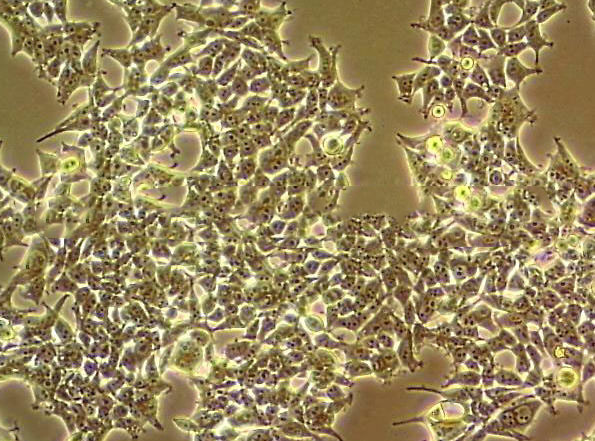 Mel-RM Cell:人黑色素瘤细胞系