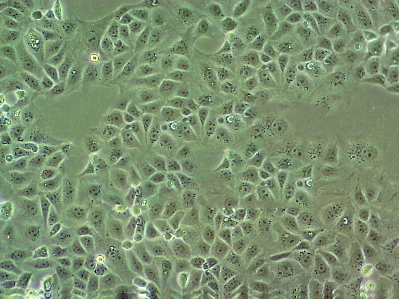 HB611 Cell:人肝母细胞癌细胞系