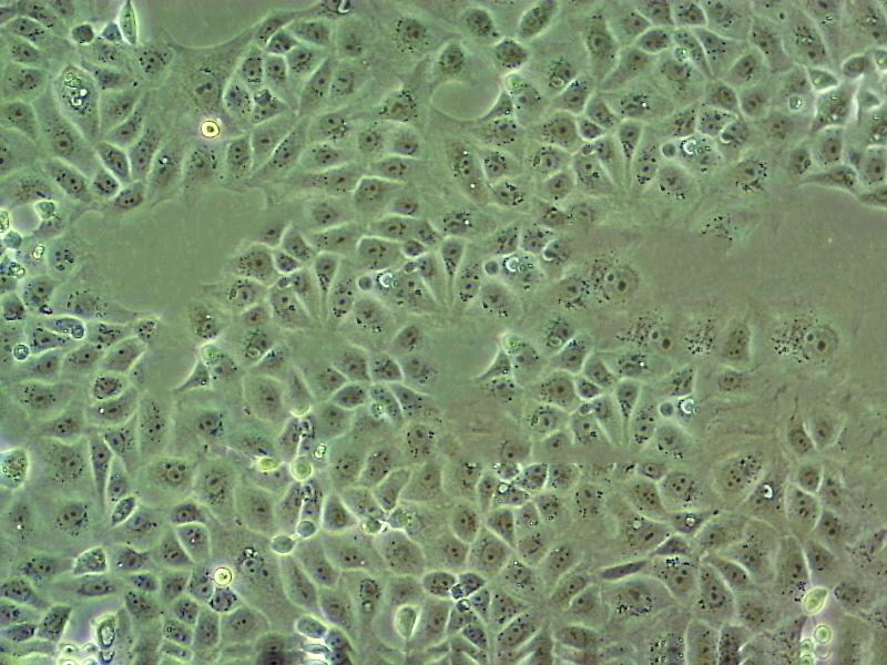 PC-14 Cell:人肺腺癌细胞系