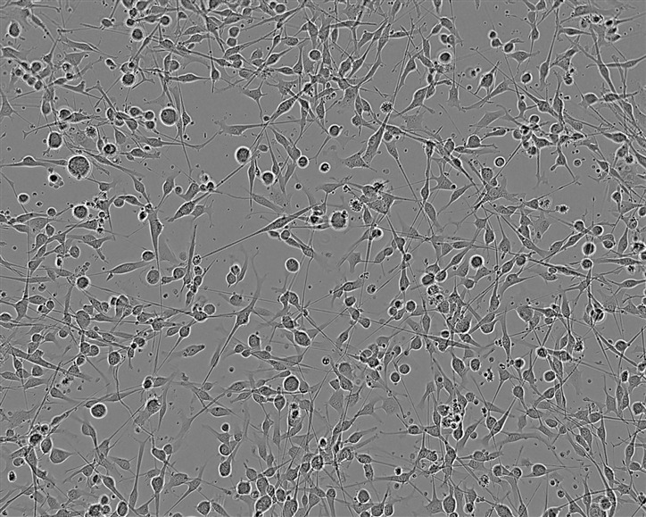 NuTu-19 Cell:大鼠卵巢癌细胞系