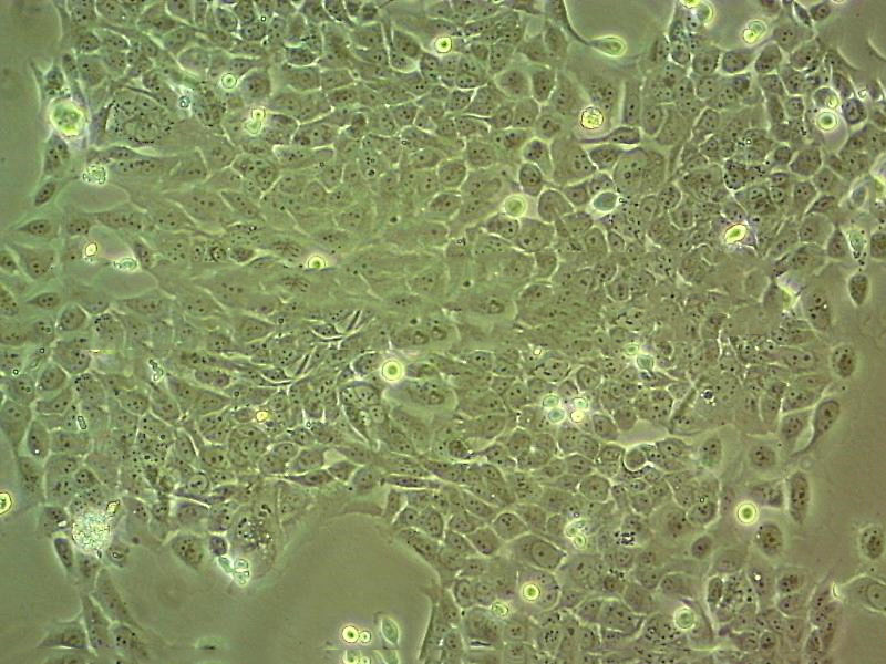 HT-1376 Cell:人膀胱癌细胞系