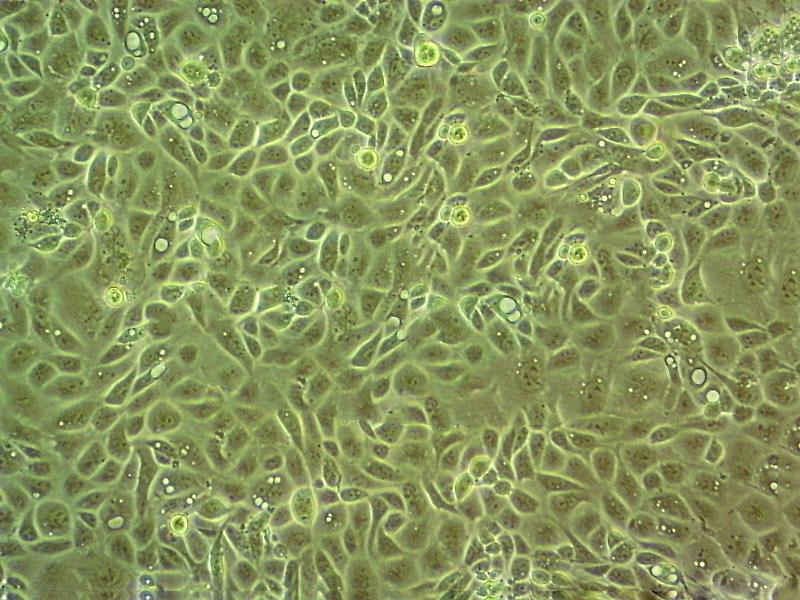 143B Cell:人骨肉瘤细胞系