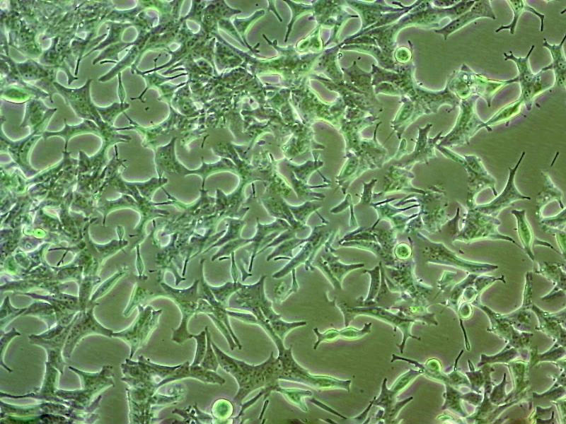 Hs 683 Cell:人脑胶质瘤细胞系