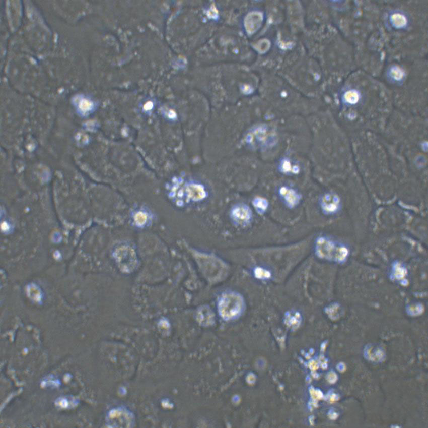 Tu 177 Cell:人喉鳞癌细胞系