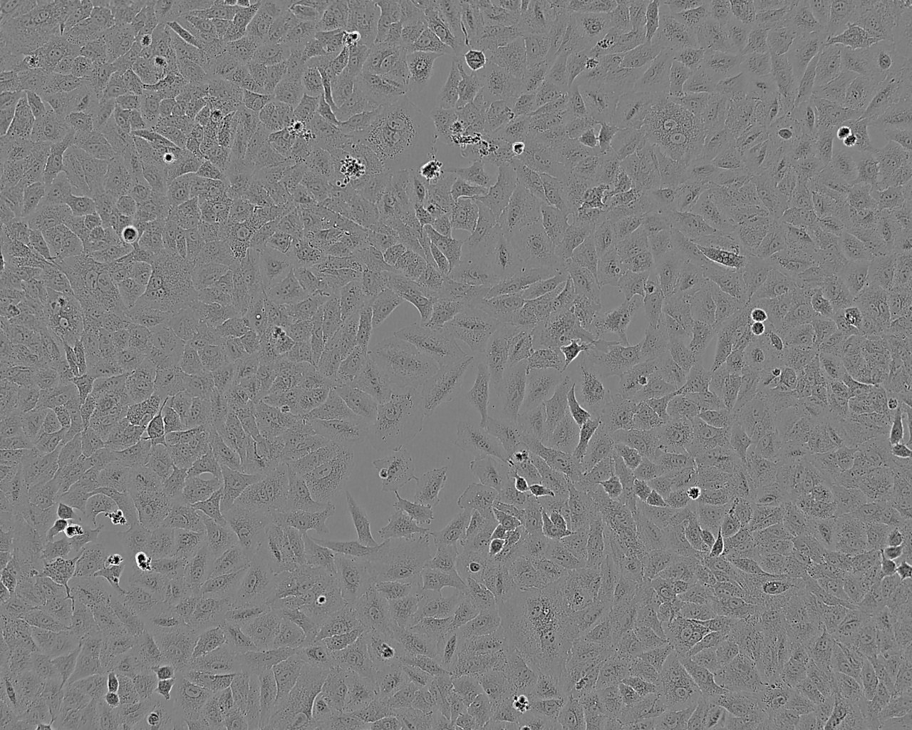 SK-RC-20 Cell:人肾癌细胞系