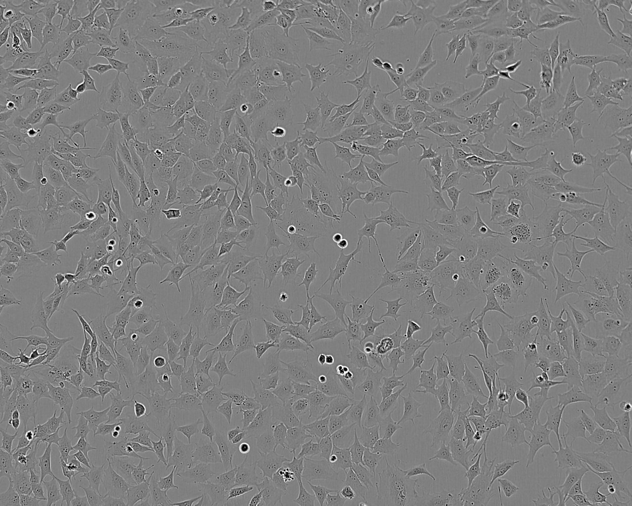 OVTOKO Cell:人卵巢透明细胞癌细胞系