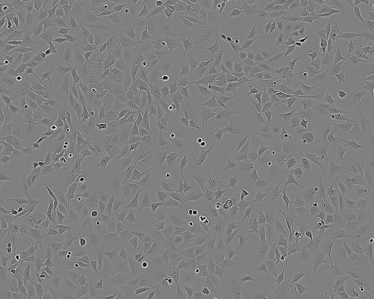 KMS-18 Cell:人浆细胞骨髓瘤细胞系