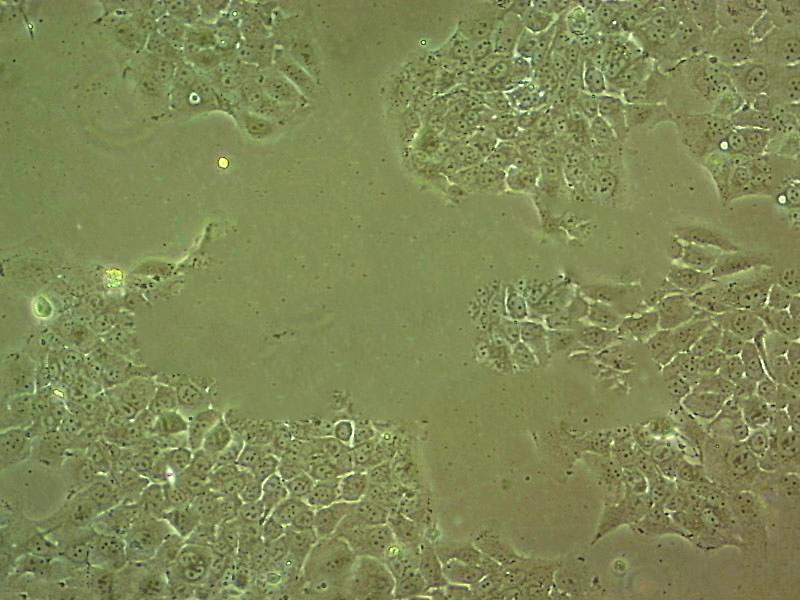 PG [Human lung carcinoma] Cell:人巨细胞肺癌细胞系