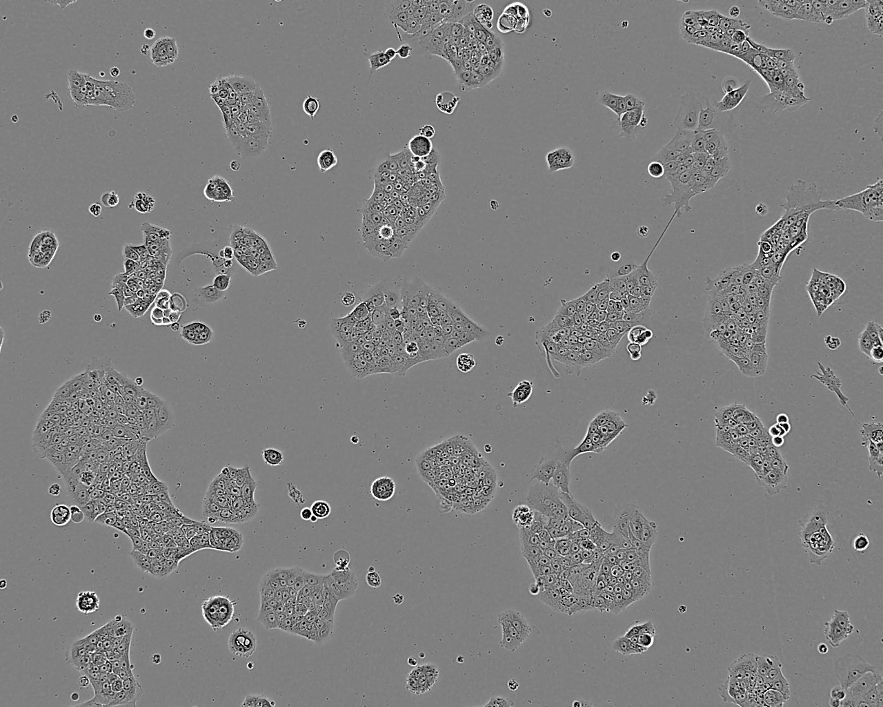 UM-UC-14 Cell:人肾癌细胞系