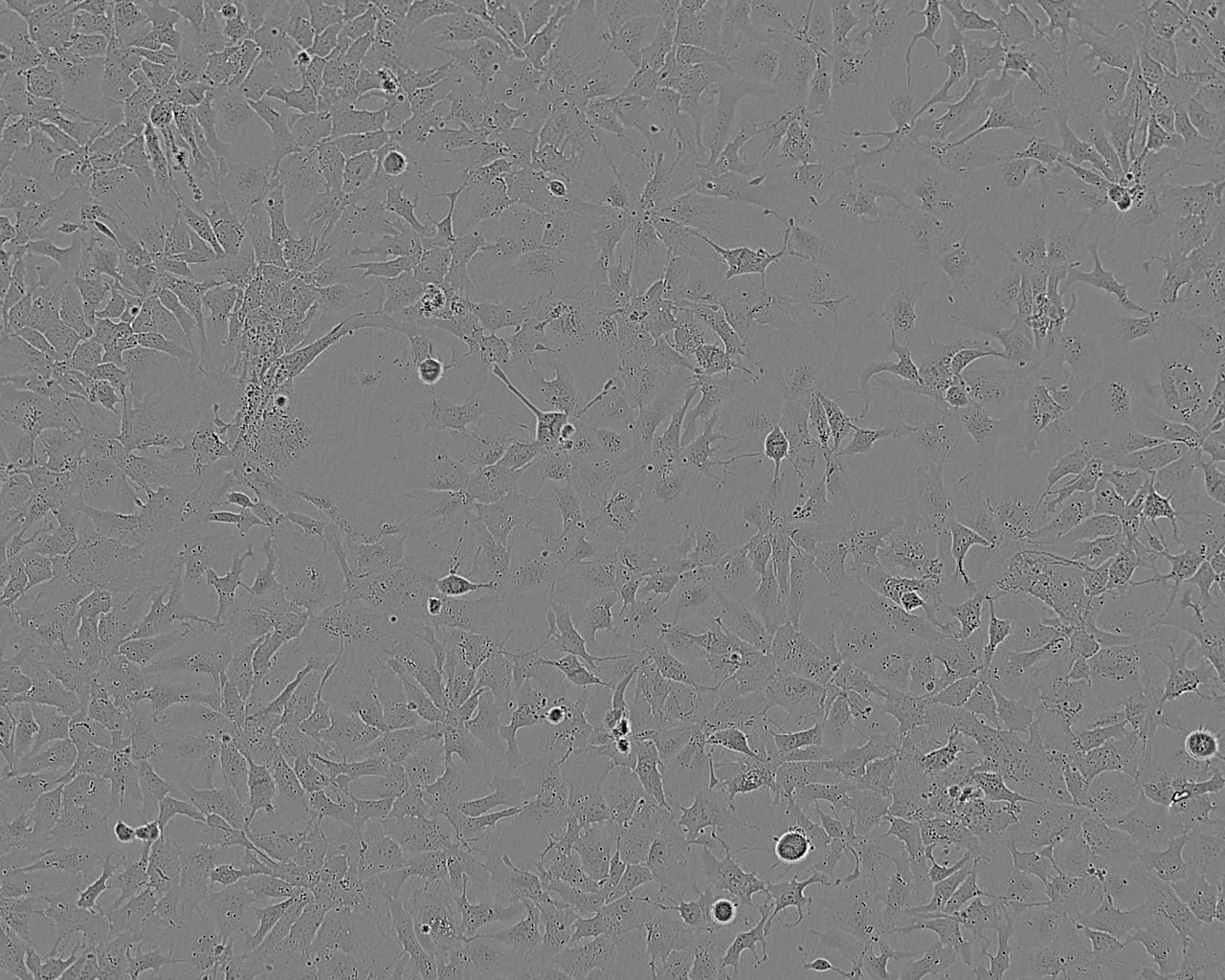 KYSE-510 Cell:人食管鳞癌细胞系