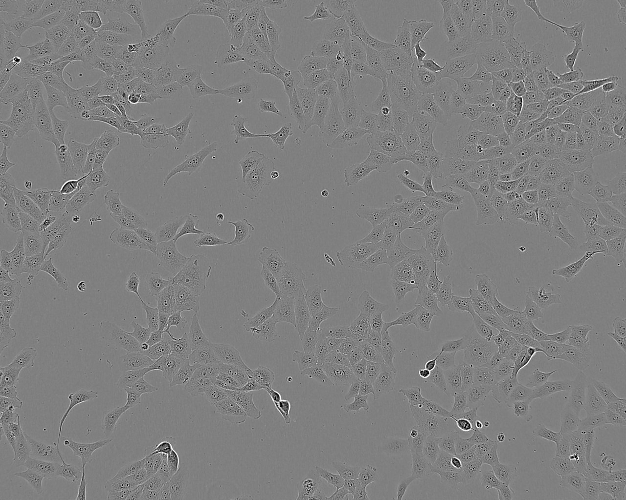 KYSE-410 Cell:人食管鳞癌细胞系