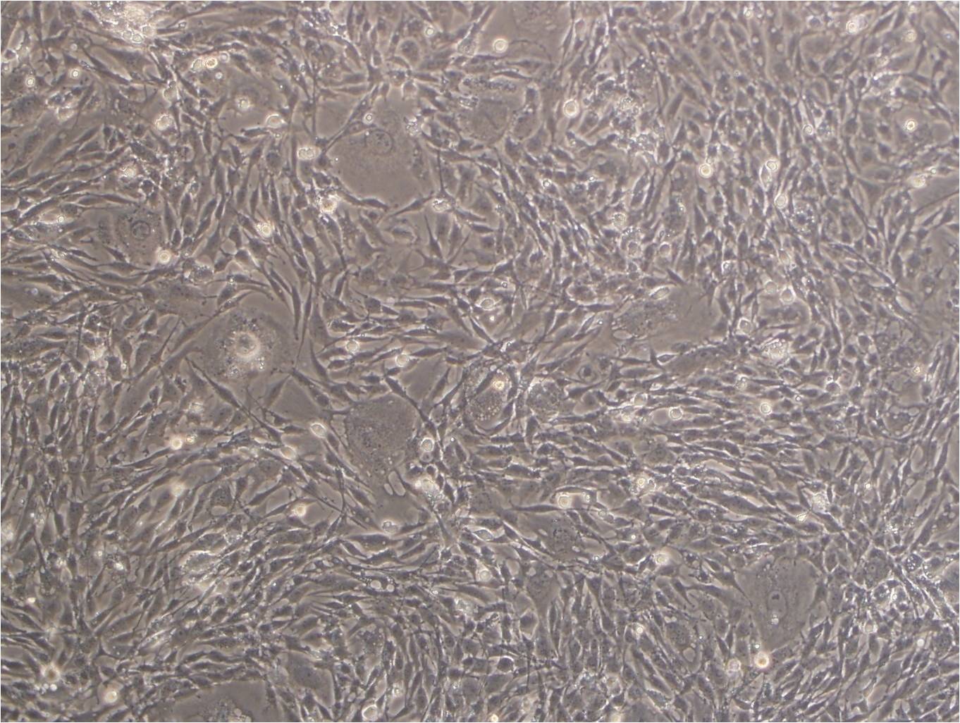 4-1st Cell:人胃癌细胞系