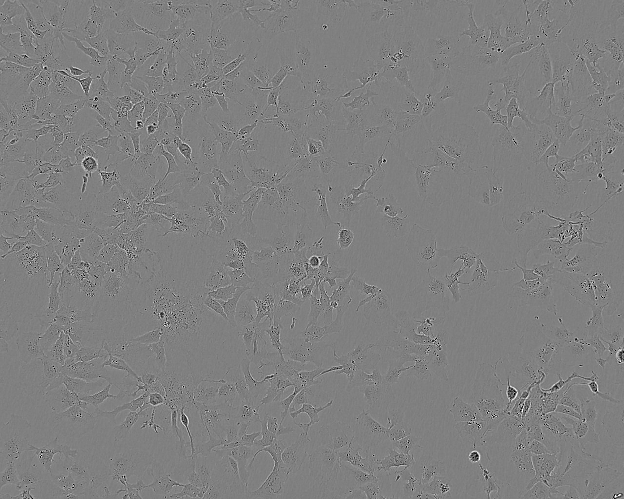 SPC-A1 Cell:人肺腺癌细胞系