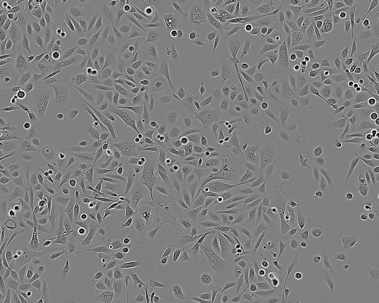 Anglne Cell:人卵巢癌细胞系