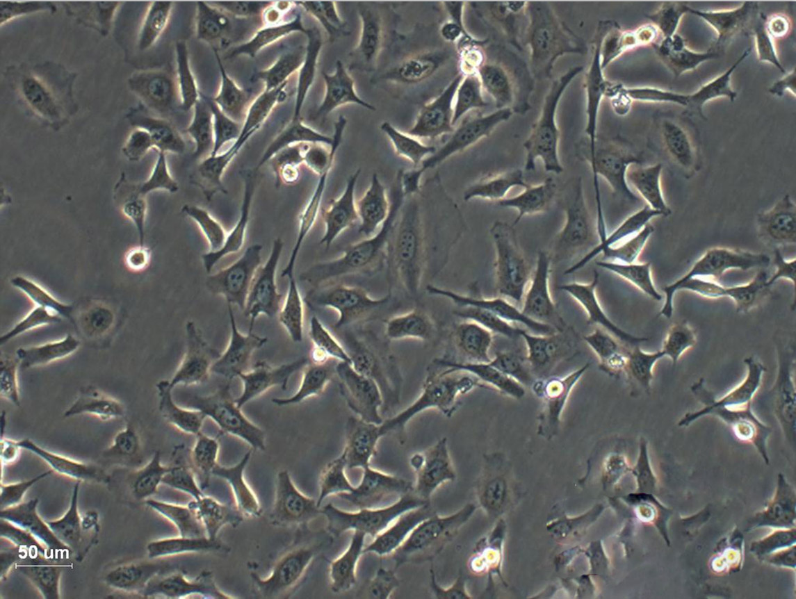 DoHH2 Cell:人胸腔积液滤泡中心母细胞系
